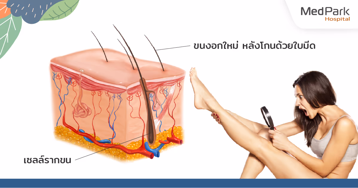 Why laser hair removal? - ทำไมต้องกำจัดขนด้วยเลเซอร์
