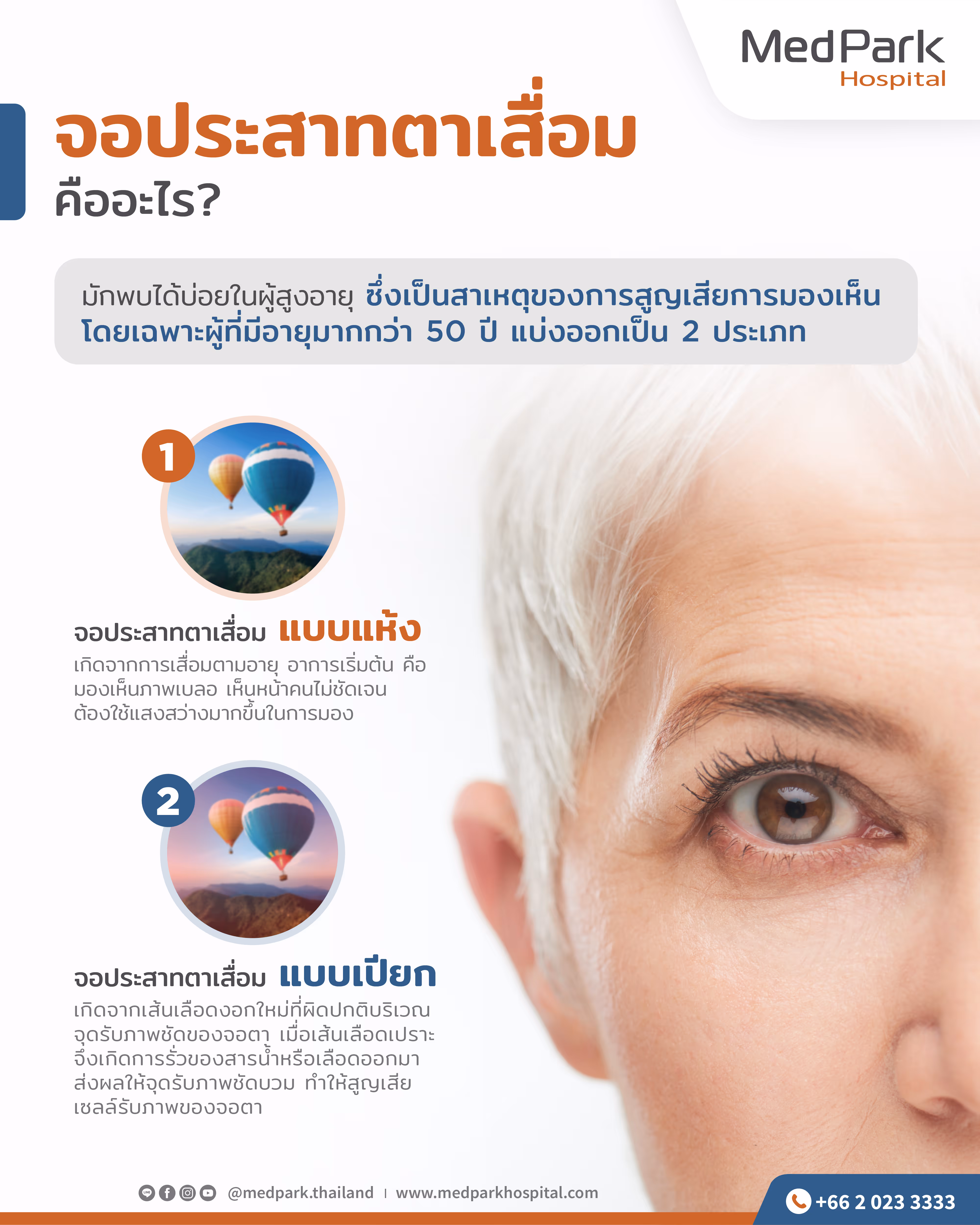 What is Age Related Macular Degeneration