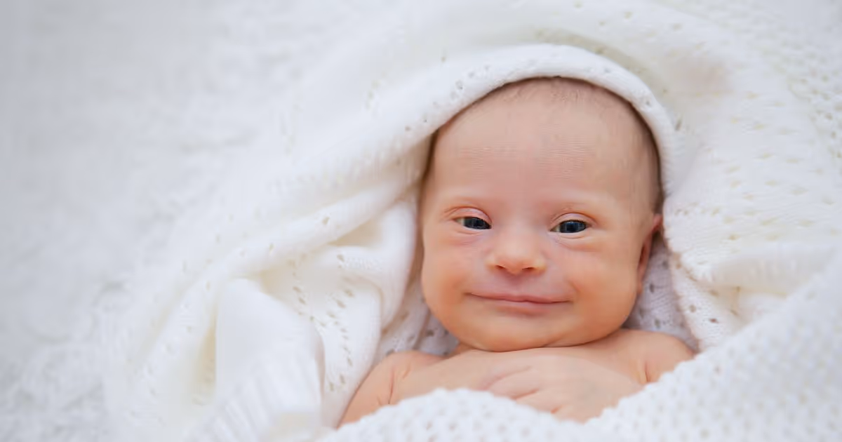 วินิจฉัยดาวน์ซินโดรม ในทารกแรกเกิด - Down syndrome diagnosed after birth