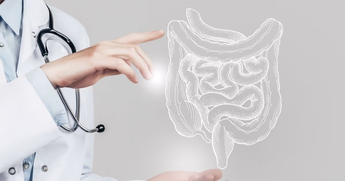 การรักษามะเร็งลำไส้ใหญ่-Colon Cancer Treatment