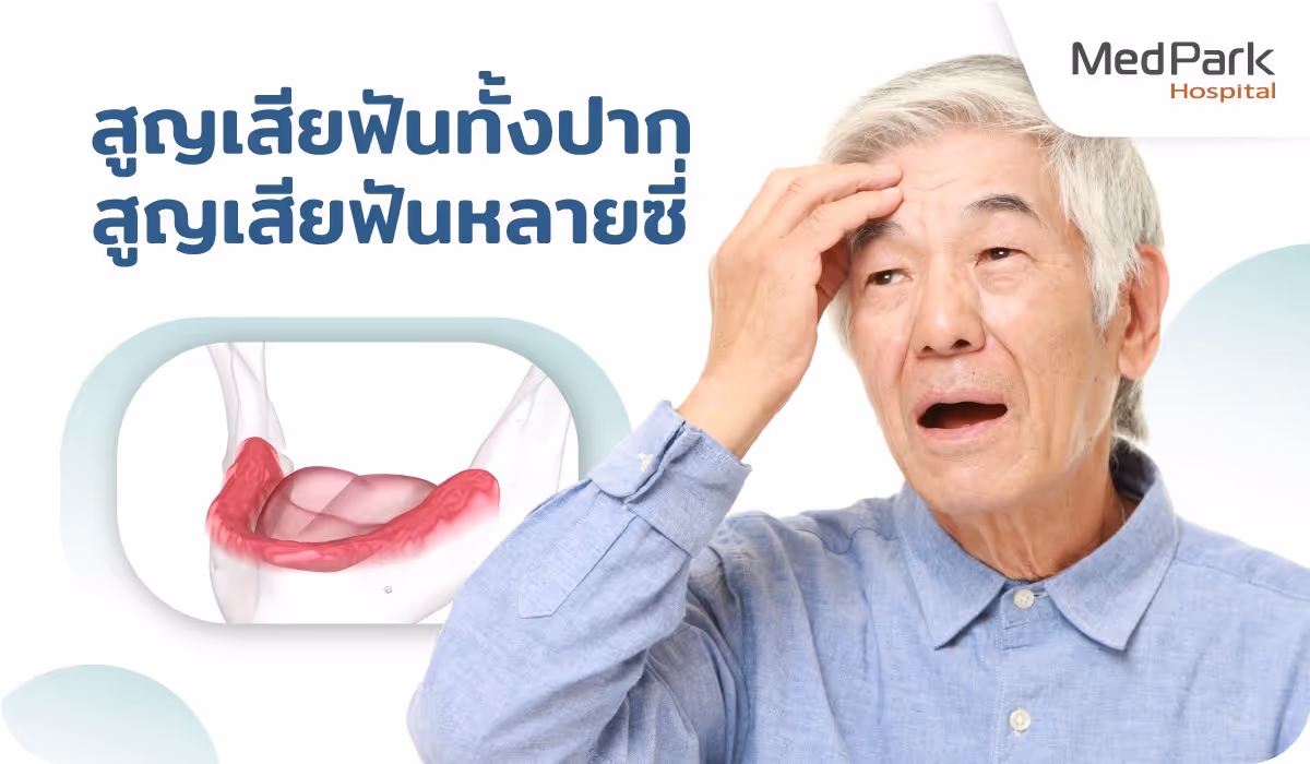 ทำไมต้องทำ All on 4