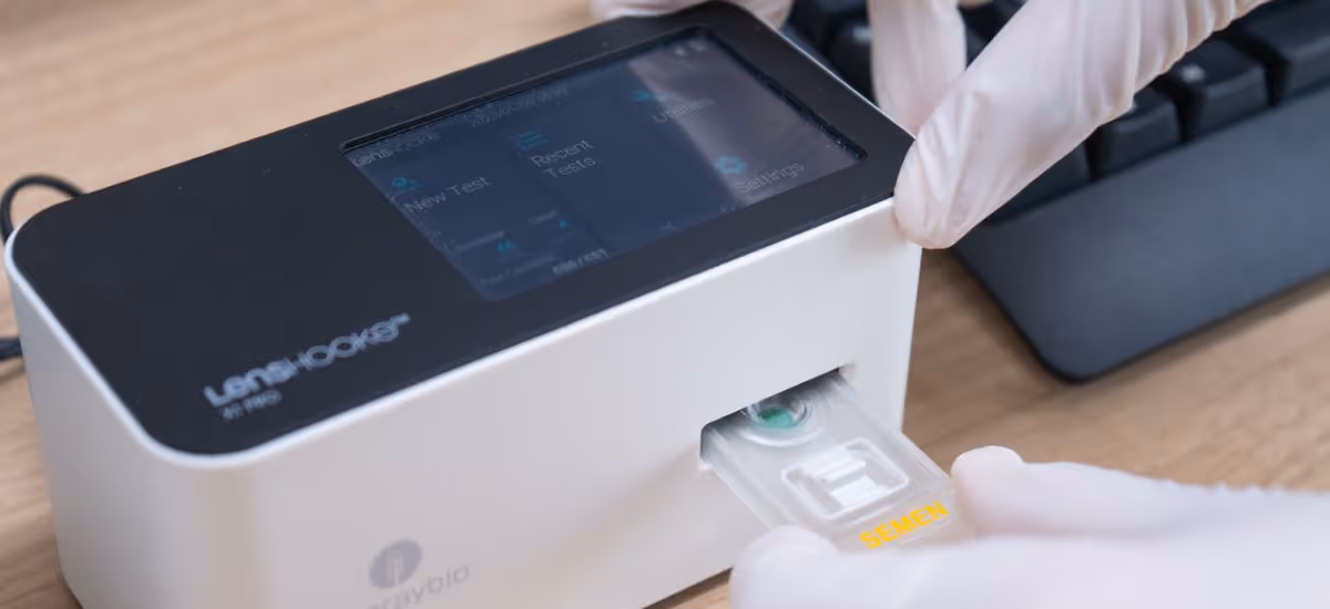 เครื่องตรวจวิเคราะห์คุณภาพน้ำเชื้อ - Automated Sperm Quality Analyzer