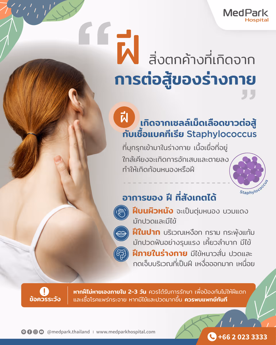 ฝี (Abscess) ประเภท อาการ สาเหตุ และการรักษา