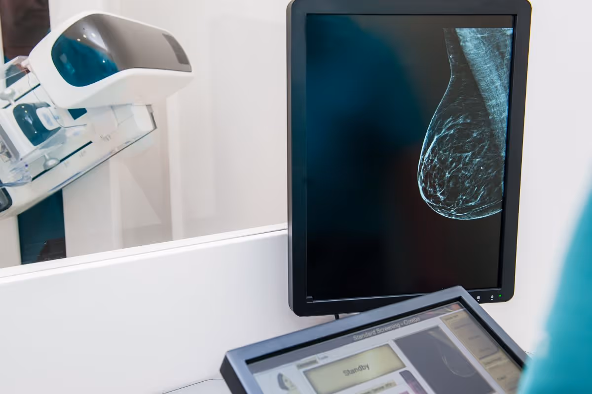 Tomosynthesis (3 D) Digital Mammography Banner 2