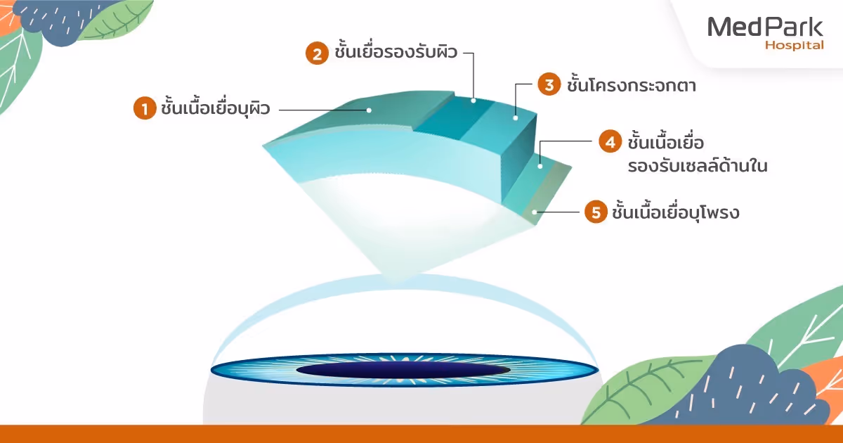 ทำไมต้องผ่าตัดเปลี่ยนกระจกตา DMEK