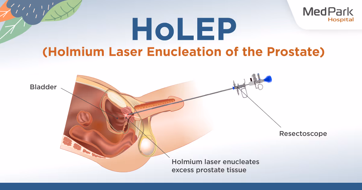 HoLEP prostate laser surgery procedure