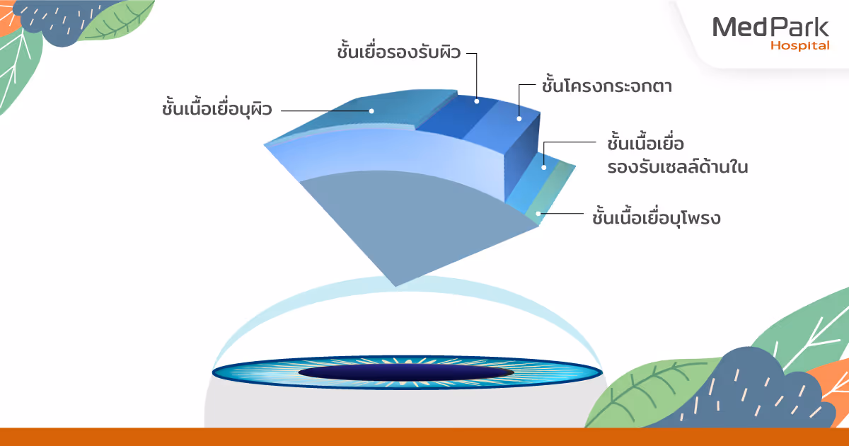 ชั้นของกระจกตาที่เสื่อม corneal endothelial dysfunction