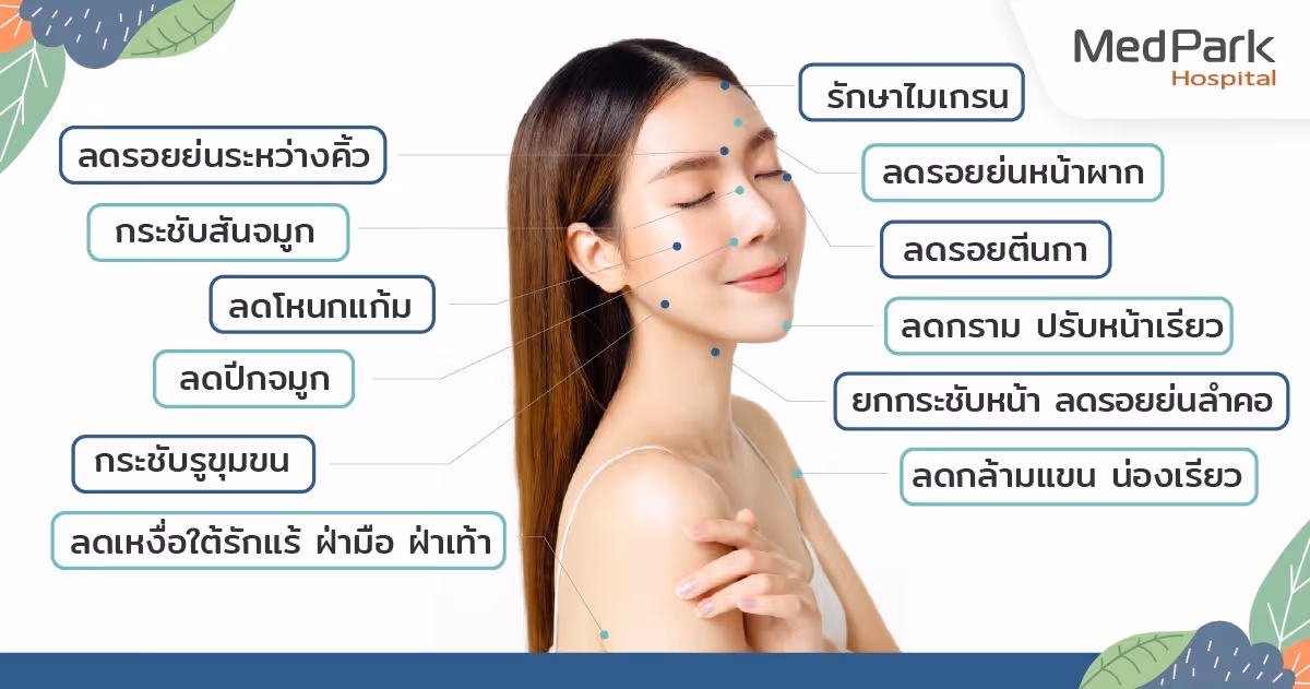 บริเวณที่นิยมฉีดโบท็อก-Common areas for Botox injections