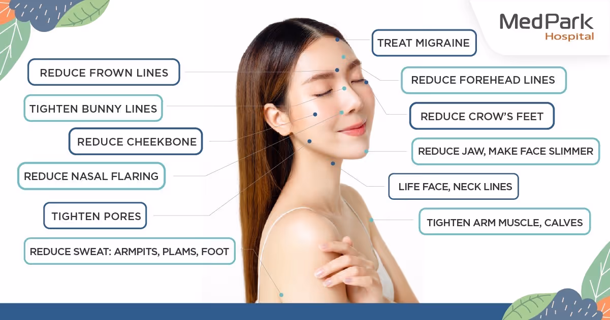 Common areas for Botox injections