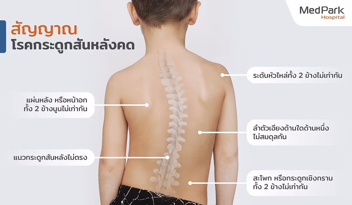 Scoliosis Surgery   Th