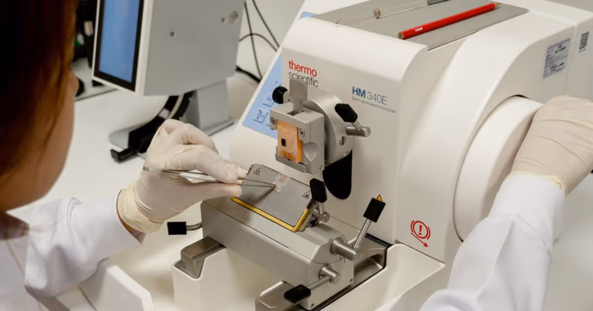 What are the results of a CBC test