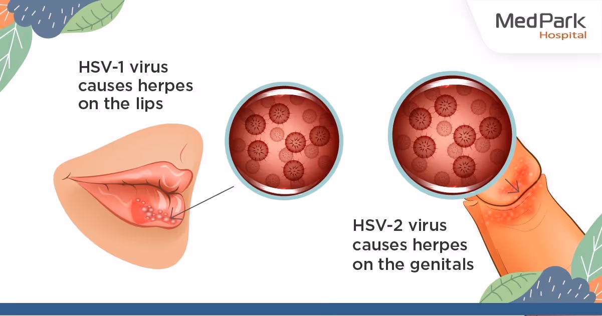 เริมมีกี่ชนิด - How many types of herpes simplex