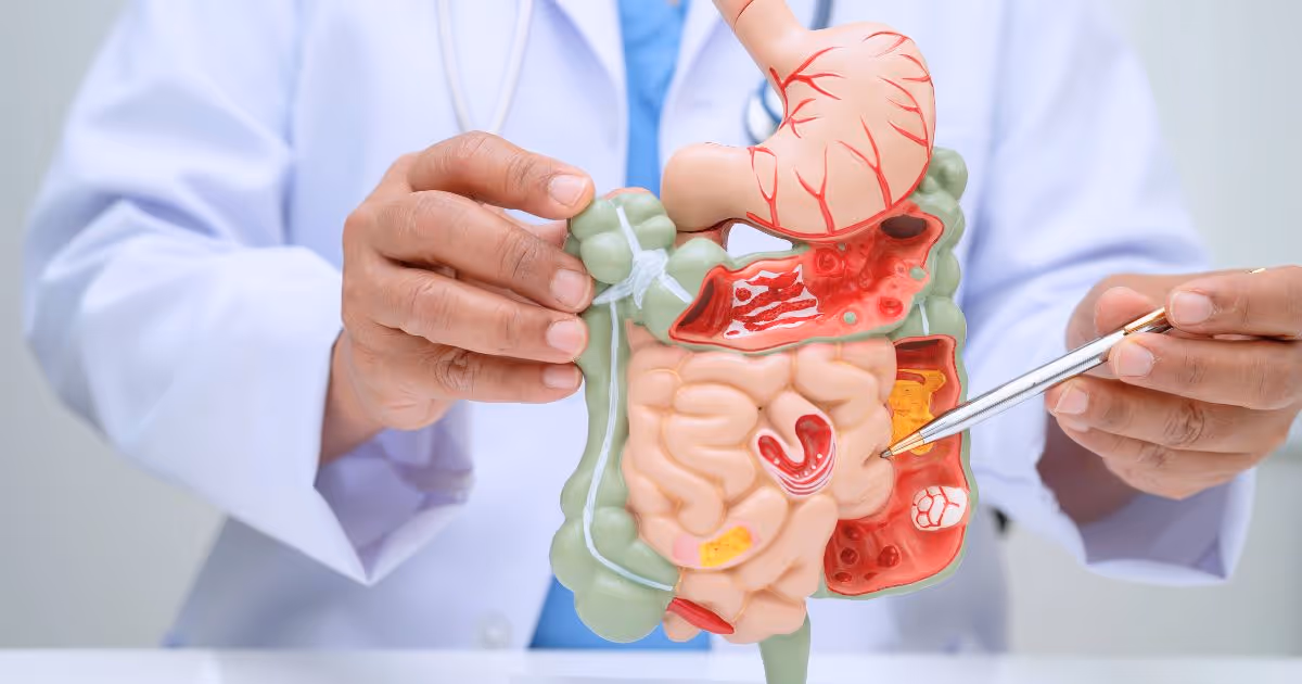 ตรวจจุลินทรีย์ใน ลำไส้ หาสาเหตุสิวเรื้อรัง ท้องผูก โรคอ้วน และอื่น ๆ - Gut Microbiome Test: Finds Chronic Disease, Benefits