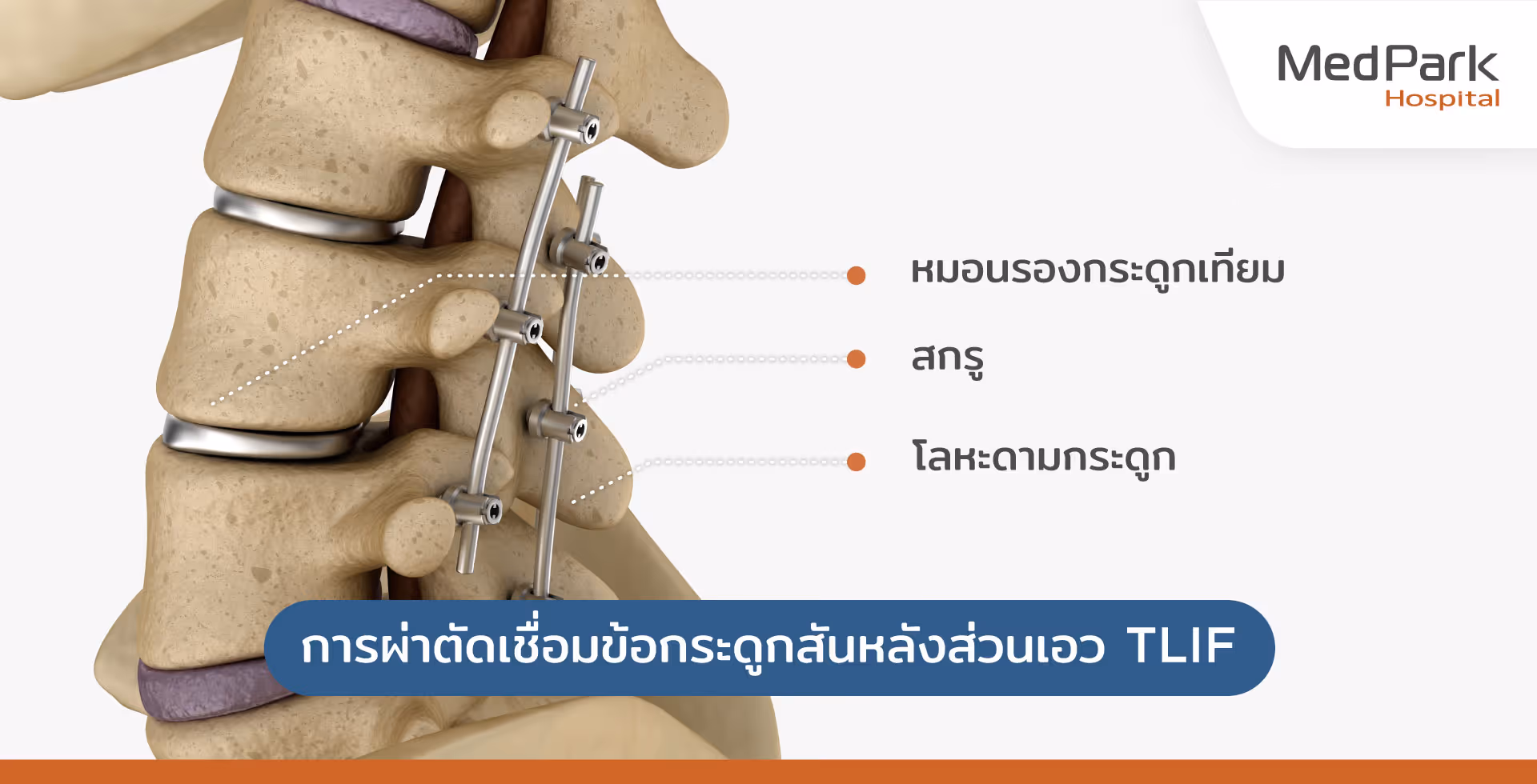 ขั้นตอนการผ่าตัดเชื่อมข้อกระดูกสันหลังส่วนเอว TLIF - the TLIF surgery procedure