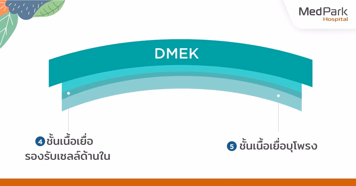 การดูแลตนเองหลังผ่าตัดเปลี่ยนกระจกตา DMEK