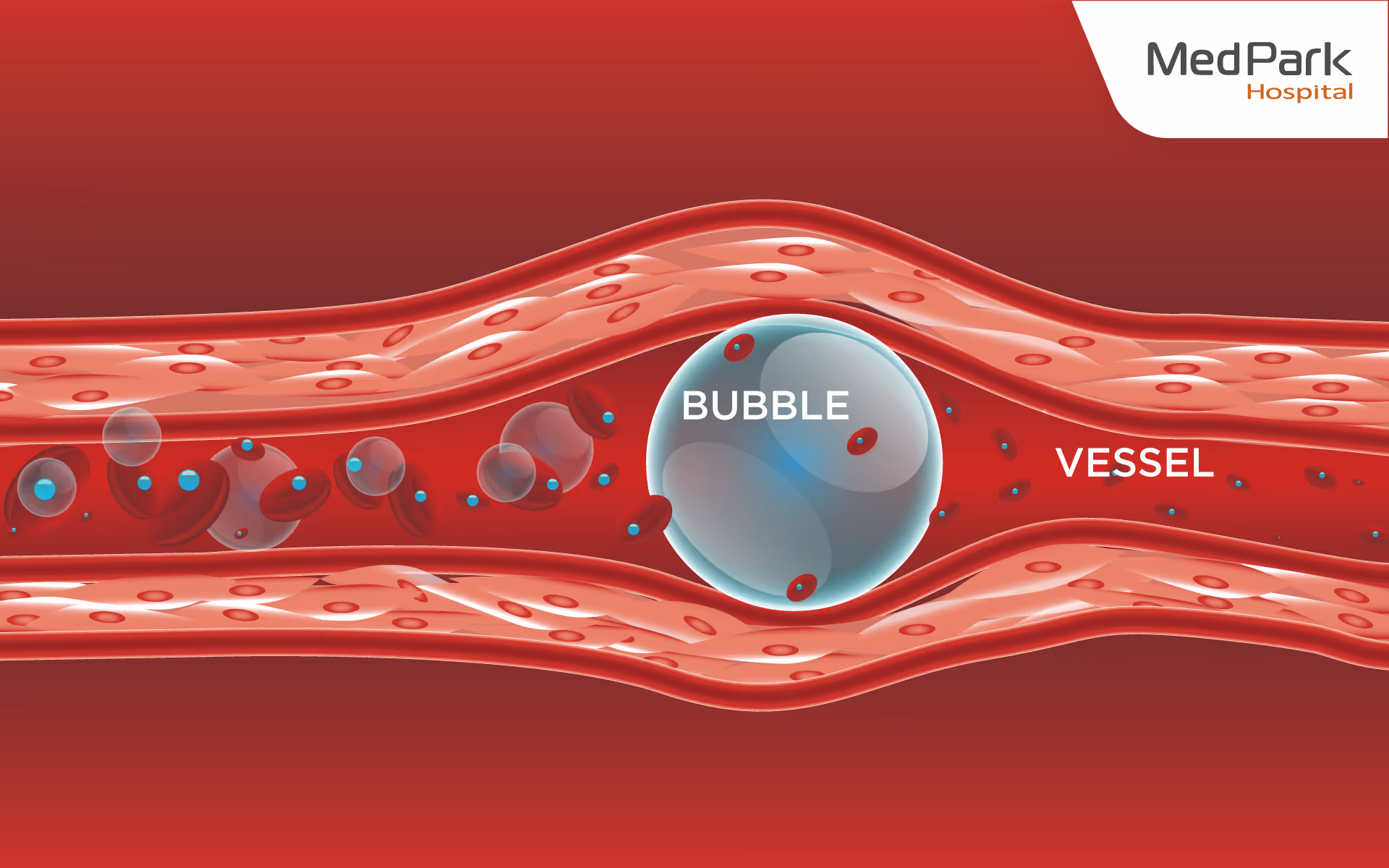 Hyperbaric Oxygen Therapy En 3
