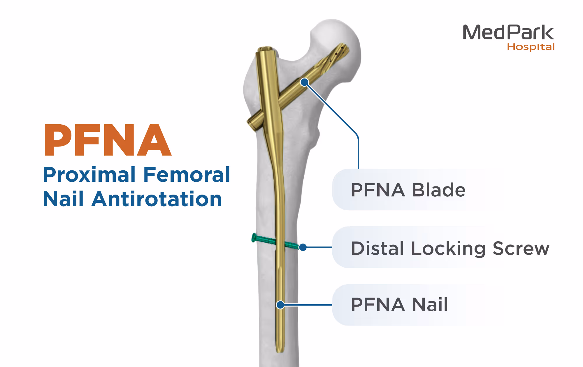 ผ่าตัด PFNA มีขั้นตอนอย่างไร What is the PFNA surgery procedure?