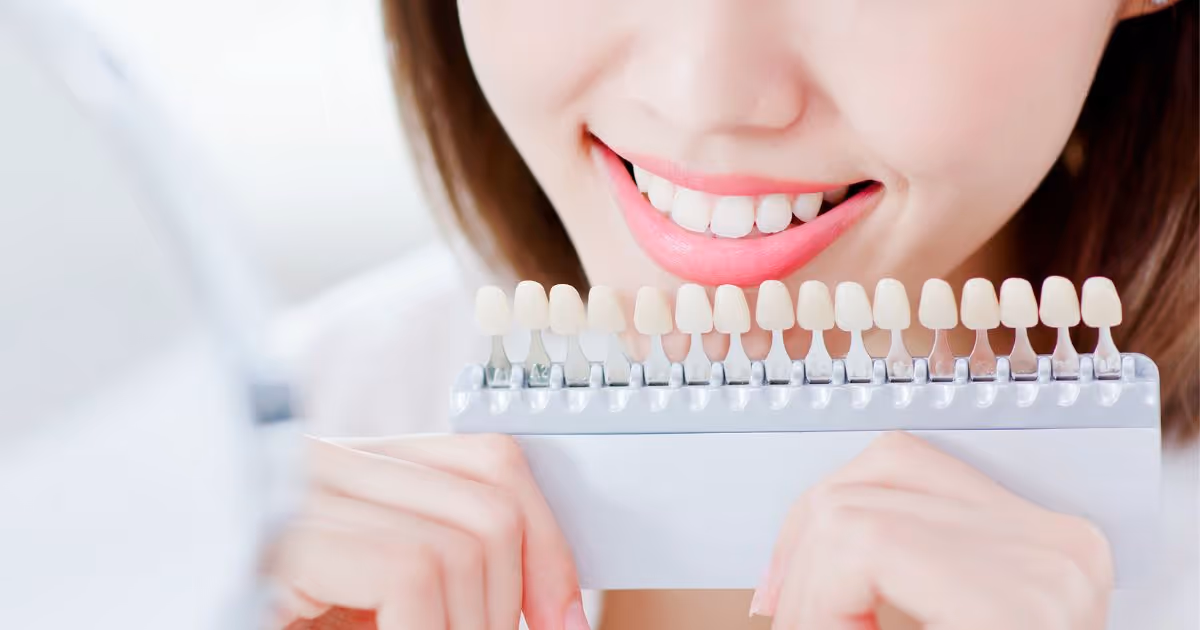 ฟอกสีฟัน ฟอกฟันขาว ฟันเหลือง ฟันดำ ขั้นตอนการทำ ราคาเท่าไหร่ - Teeth Whitening Treatment, Yellow teeth, Black teeth, Procedures, Fees