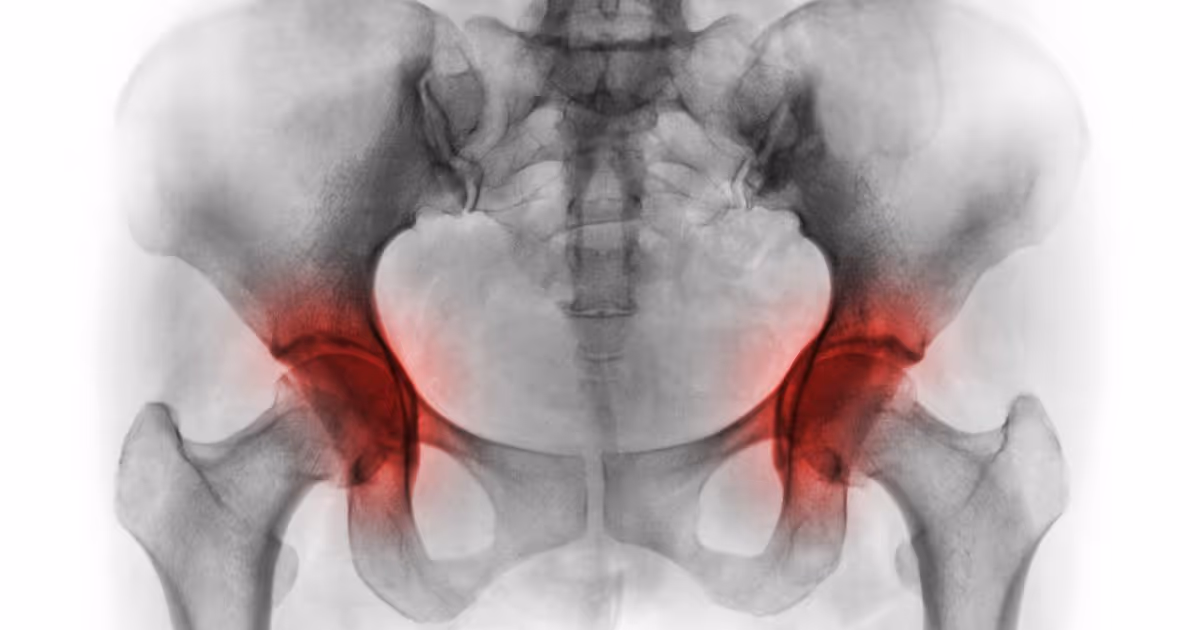 Hip Replacement Banner 2