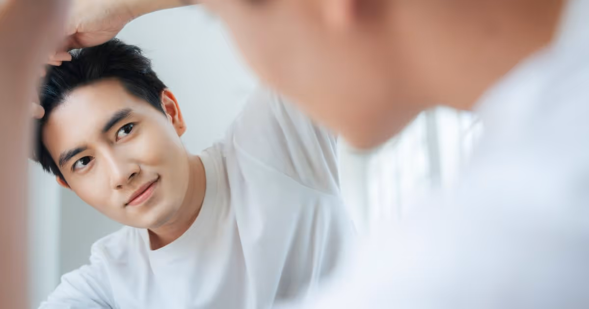 Fue Hair Transplant 2