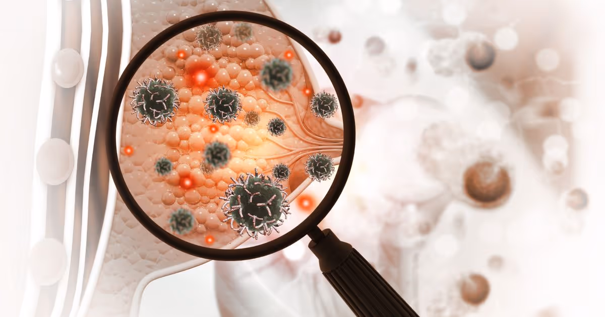 Evolution and Treatment of Breast Cancer by Stage 3 (1)