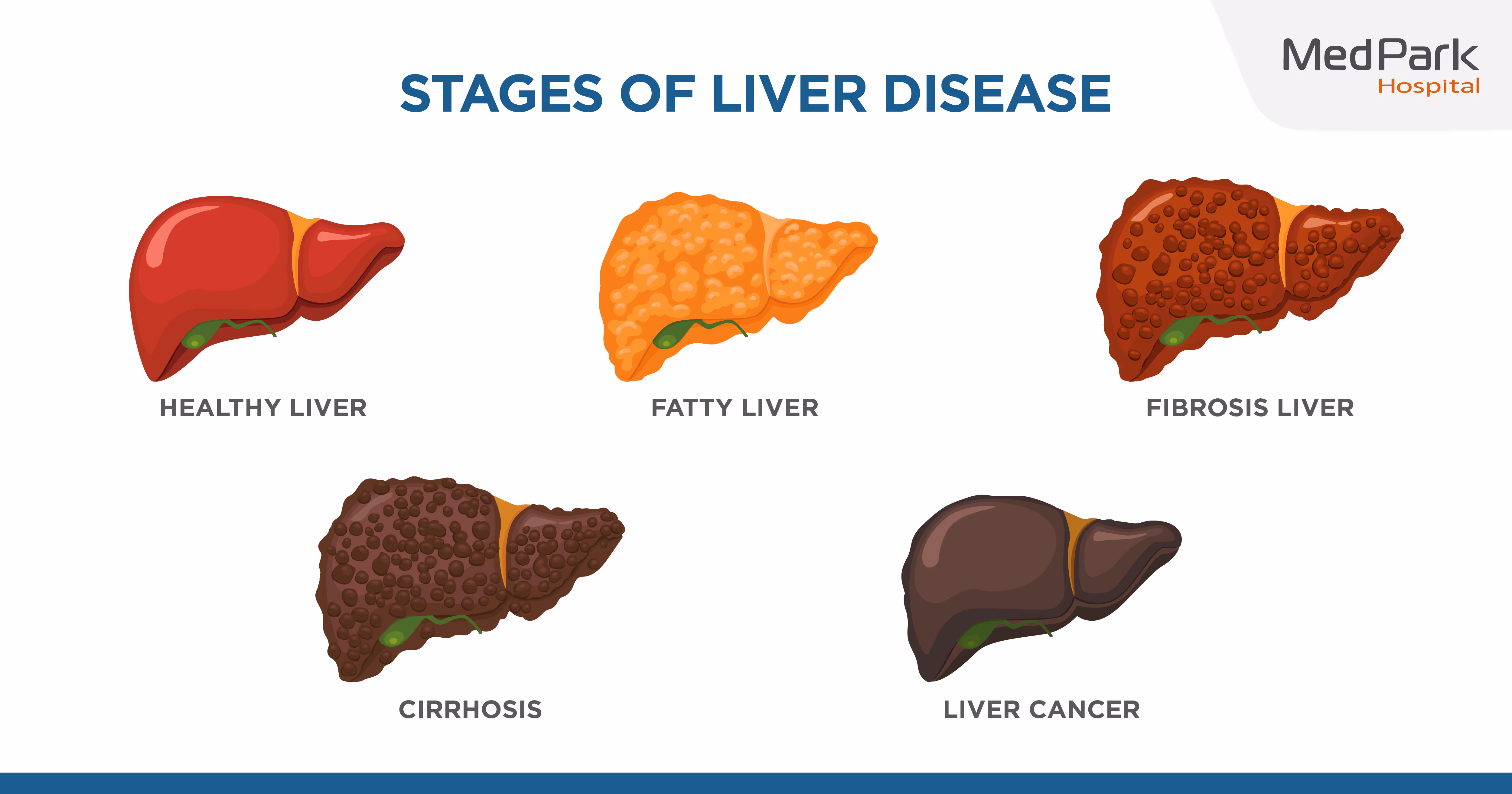 ผลการตรวจไฟโบรสแกน ไฟโบรสแกนค่าปกติ คือเท่าไหร่ FibroScan Results: What is a normal FibroScan score?