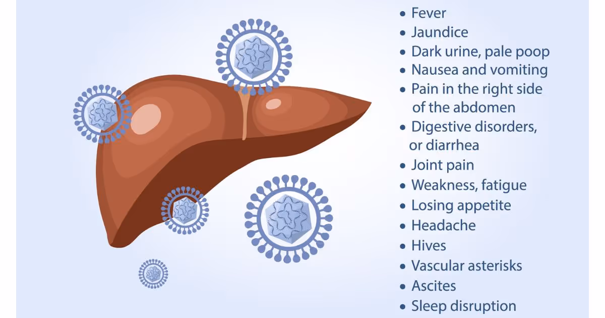 ไวรัสตับอักเสบบซี อาการ