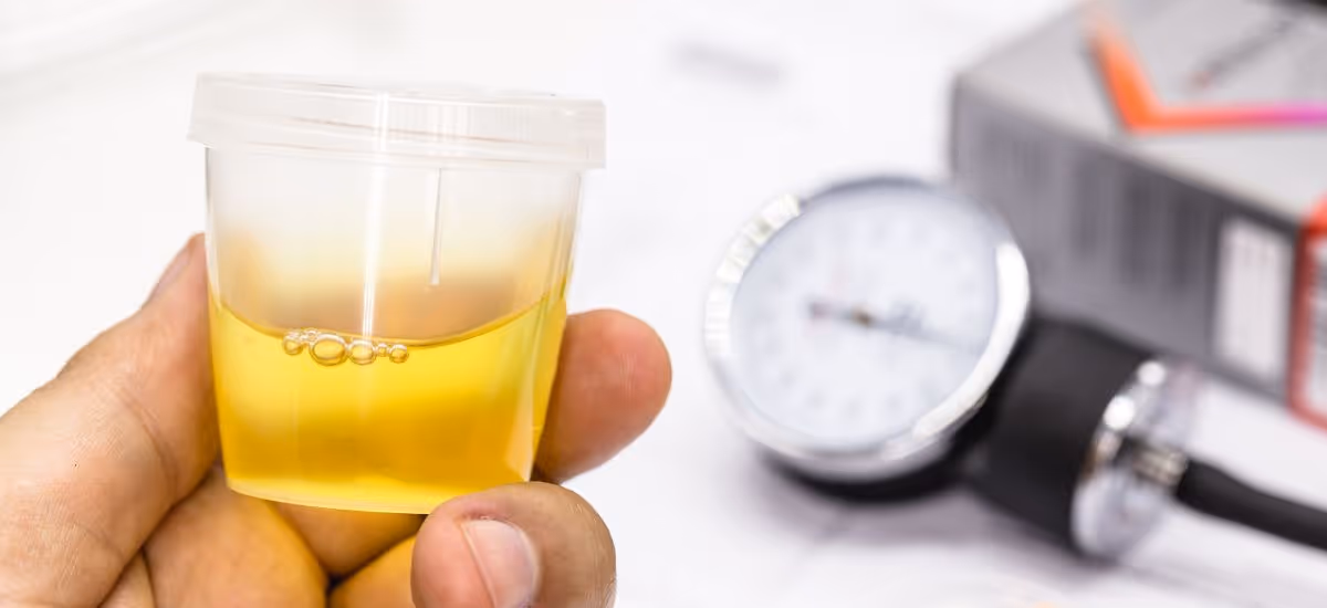 Blood in the Urine Banner 3