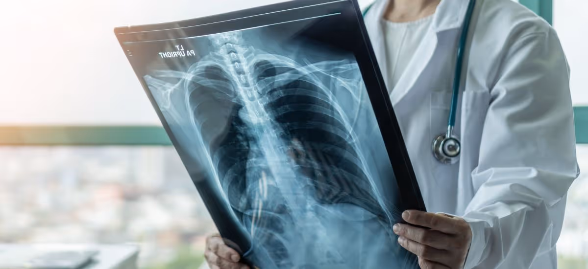 การตรวจวินิจฉัยโรคมะเร็งปอด - Lung Cancer