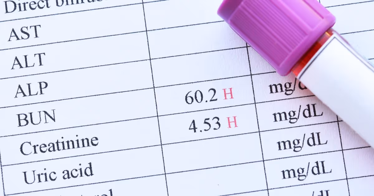ตรวจการทำงานของไต ตรวจค่าไต BUN Creatinine eGFR - Kidney Function Tests