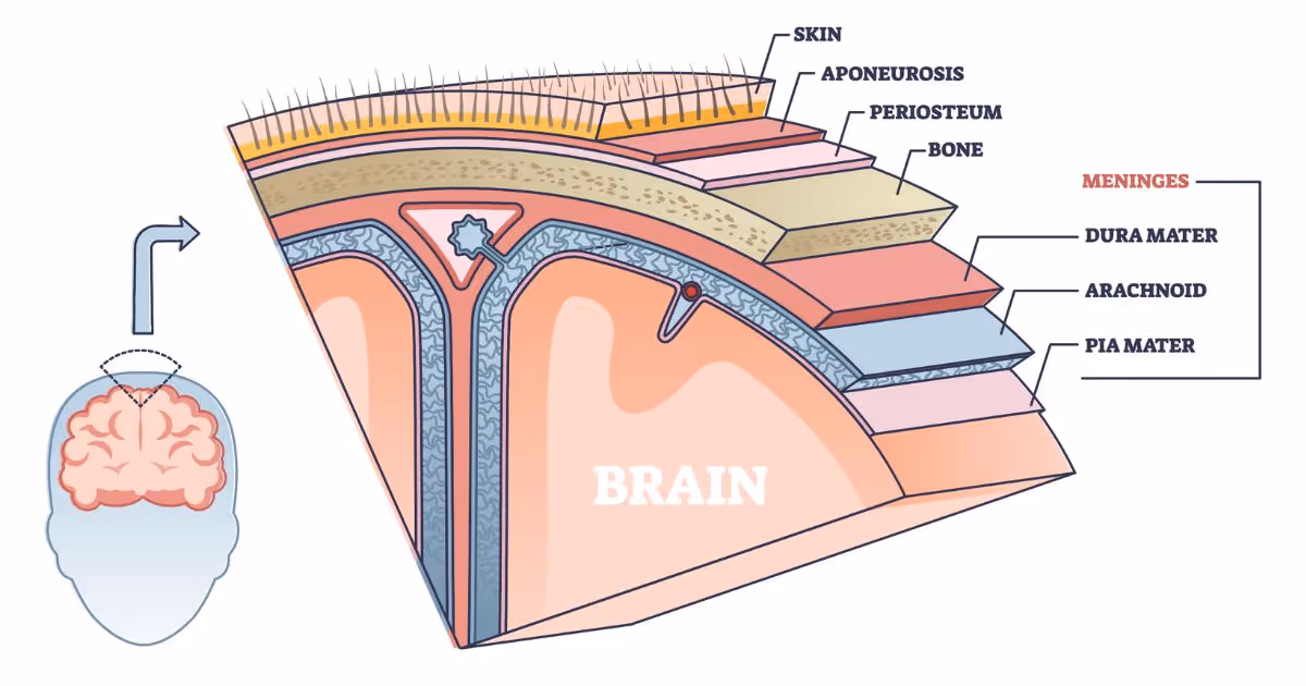 ประเภทของโรคเยื่อหุ้มสมองอักเสบ มีอะไรบ้าง? - Types of meningitis