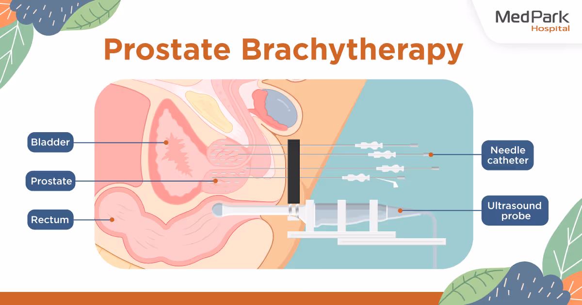 Prostate Brachytherapy Banner 2 En