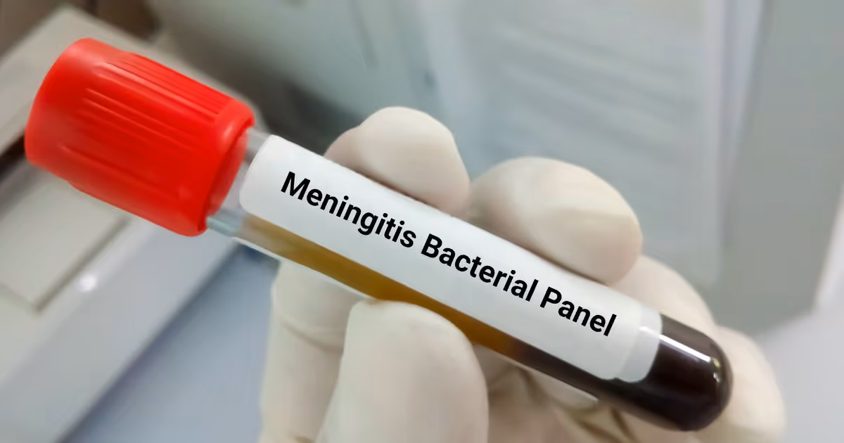 การตรวจวินิจฉัยโรคเยื้อหุ้มสมองอักเสบ Meningitis