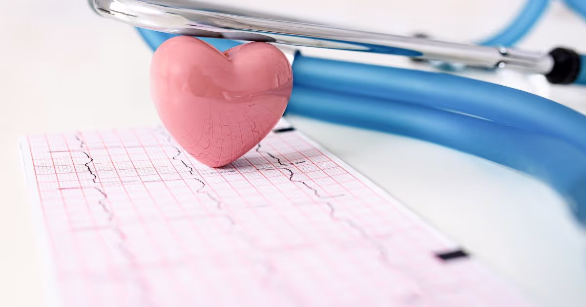 อาการ สาเหตุ การตรวจวินิฉัย และการรักษาโรคหัวใจเต้นผิดจังหวะ (Heart arrhythmia)