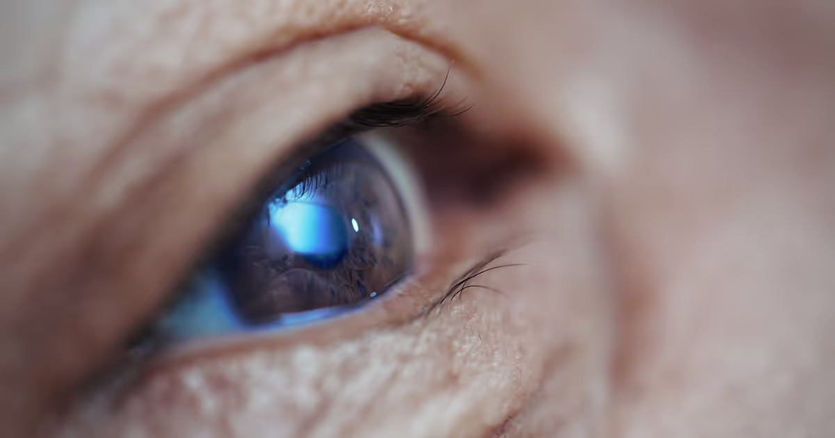 ภาวะวุ้นตาเสื่อม : อาการ สาเหตุ การวินิจฉัยและรักษา Eye Floaters