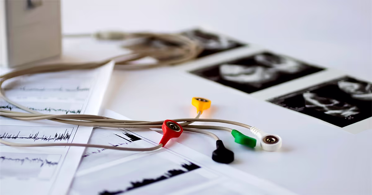 Holter monitor เครื่องบันทึกคลื่นไฟฟ้าหัวใจ 24 ชั่วโมง