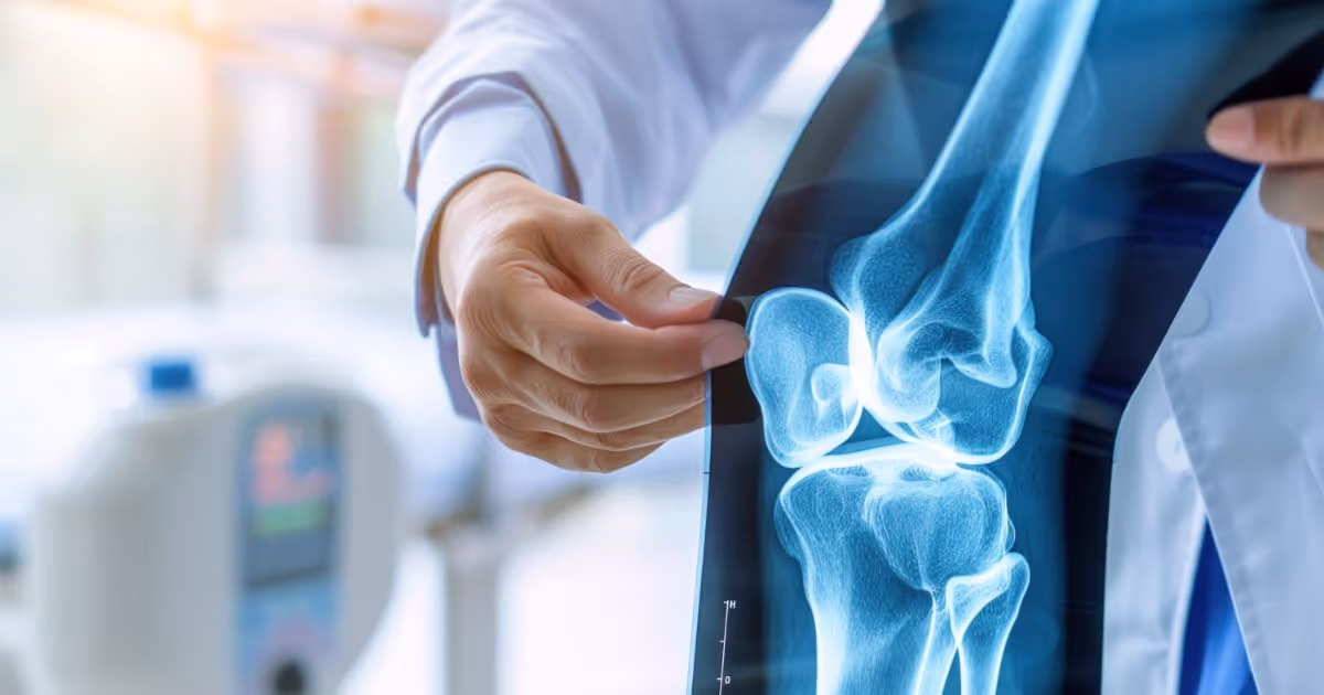 7 Orthopedic Myths Clarified, An Orthopedic Surgeon