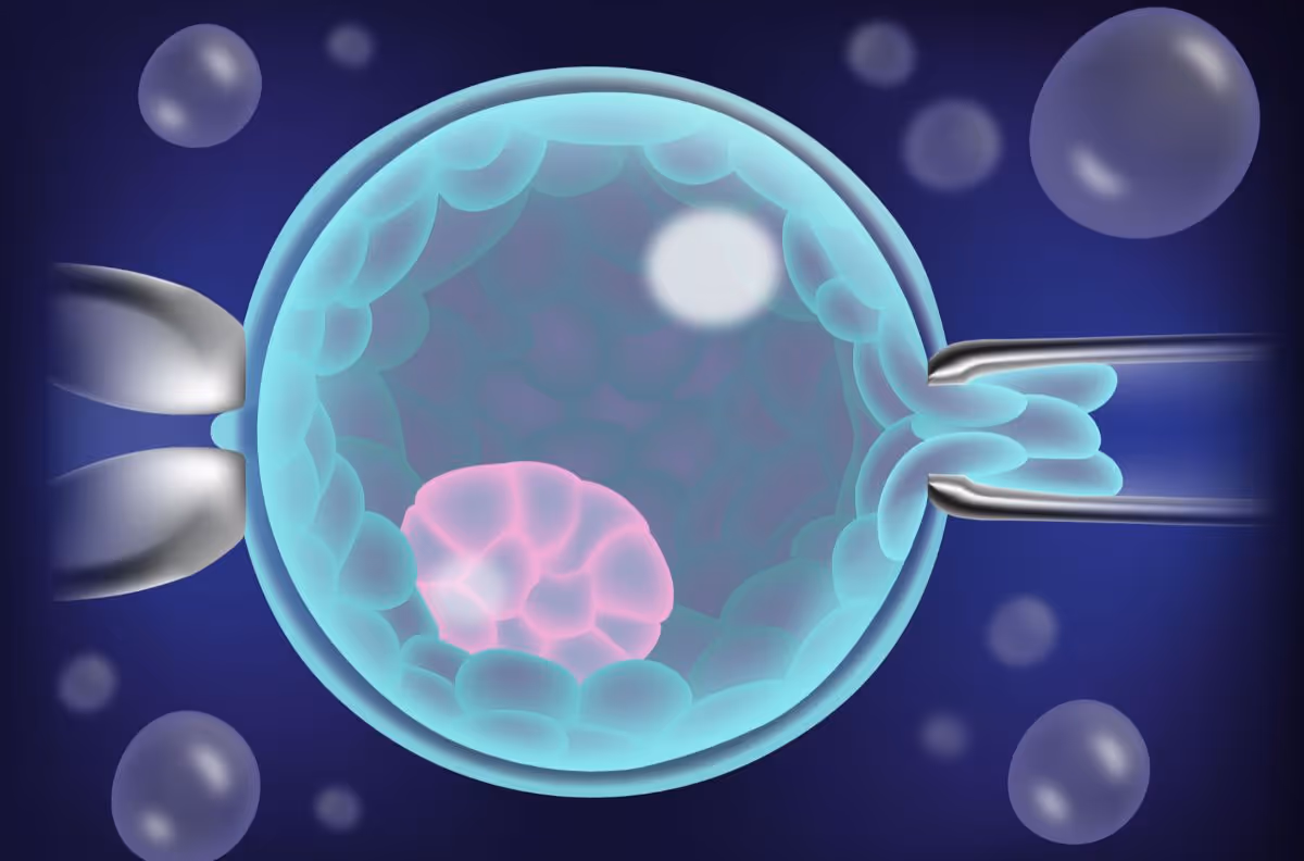 What Is the Pgt a Procedure - ขั้นตอนการตรวจโครโมโซมตัวอ่อน PGT-A