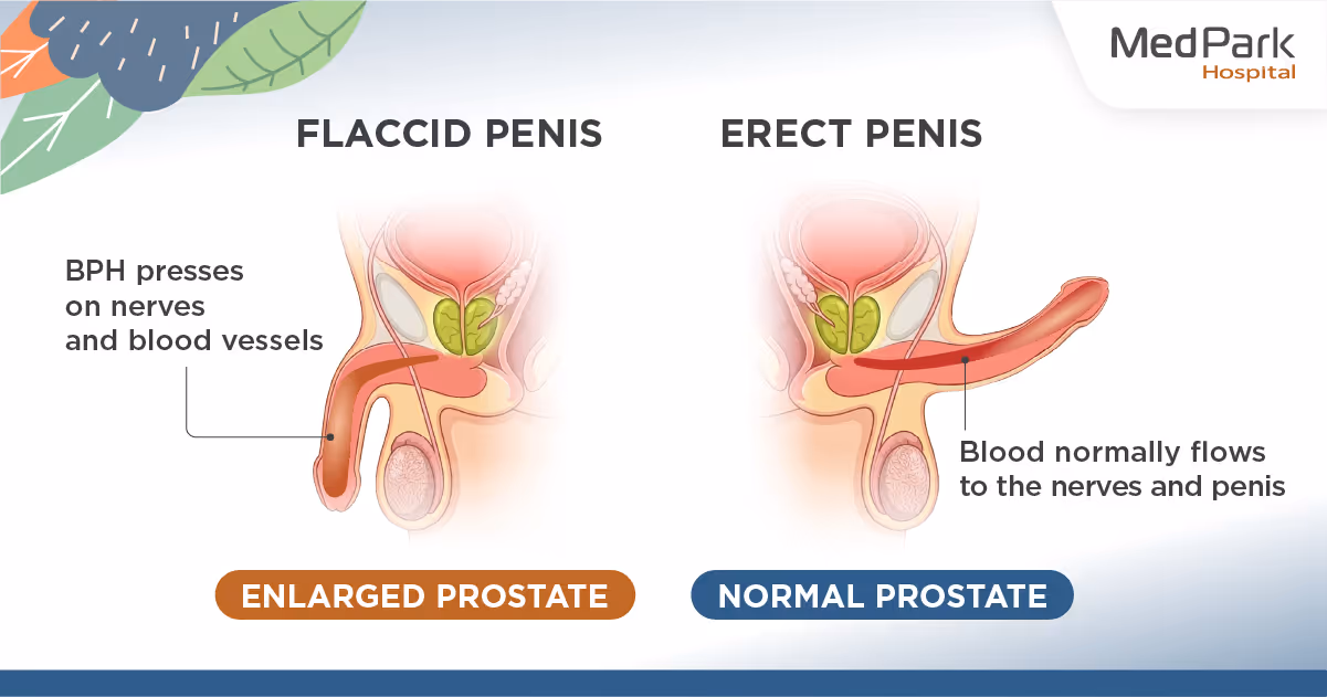 Before and After HoLEP prostate laser surgery