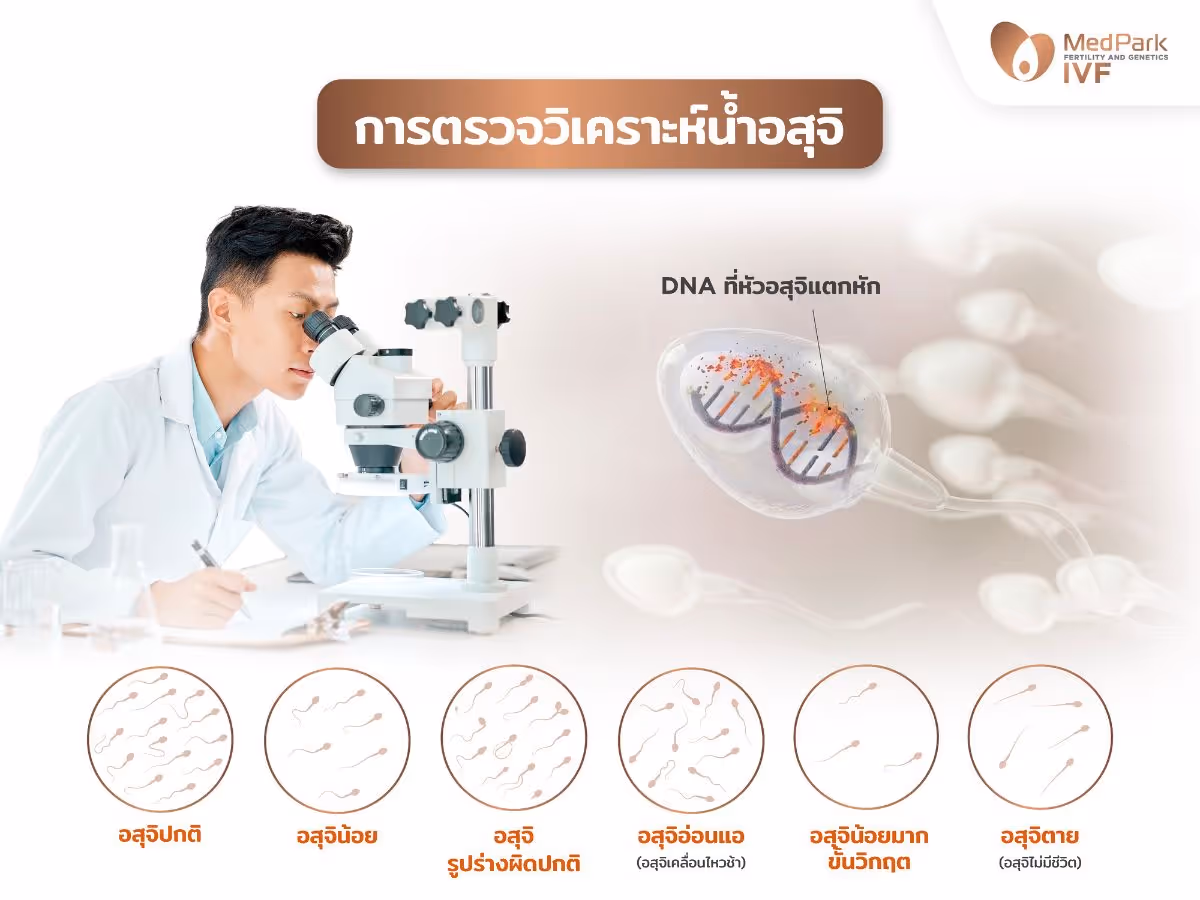 นักวิทยาศาสตร์ตรวจวิเคราะห์คุณภาพของอสุจิ และการแตกหักของ DNA ที่หัวของอสุจิ (DFI)
