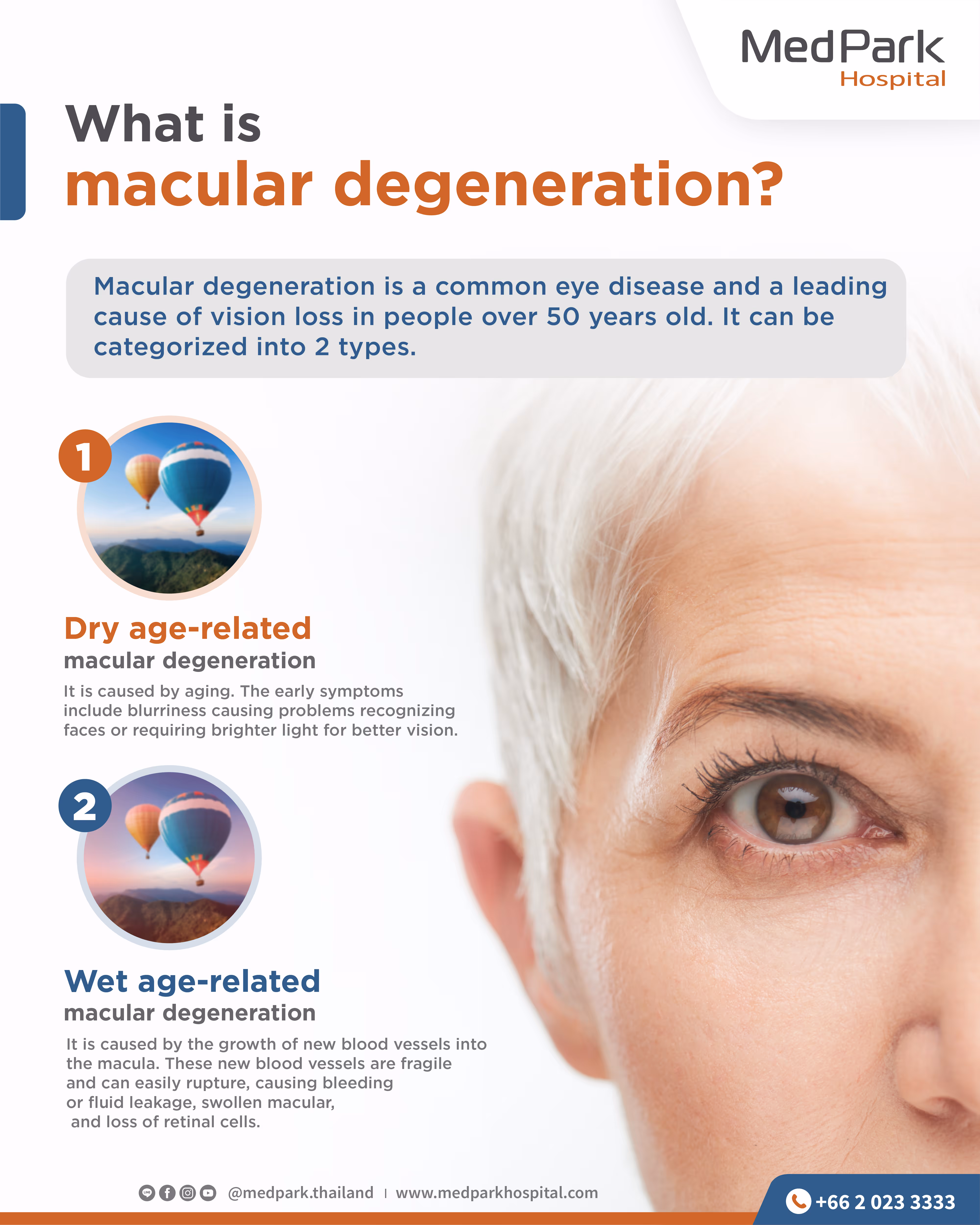 What is Age Related Macular Degeneration